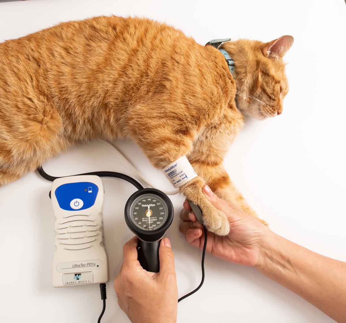Blood pressure measurement using the Doppler technique 