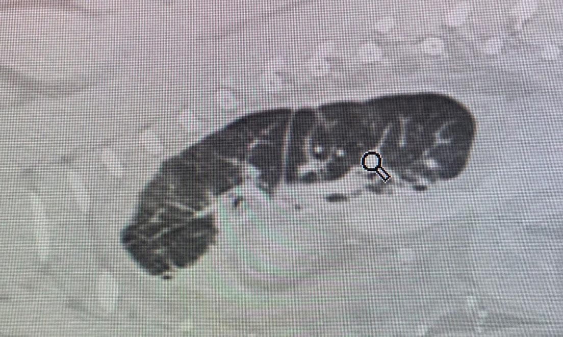 A lateral thoracic radiograph from a cat with restrictive pleuritis; note the rounded lung lobes (solid blue line) and the pneumothorax ex vacuo (dotted blue line) following removal of the chylous effusion