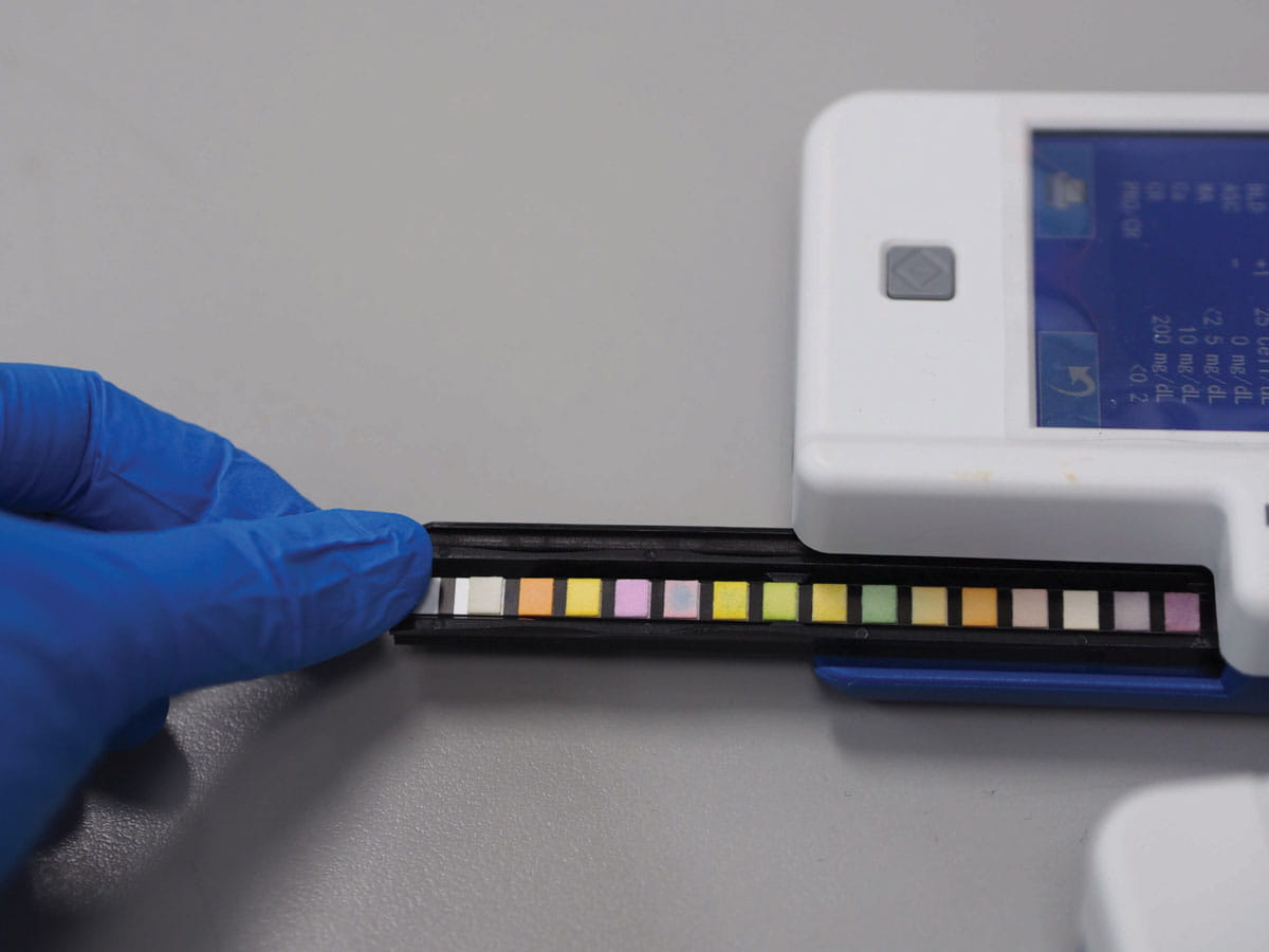 Reagent strip used to measure proteinuria.