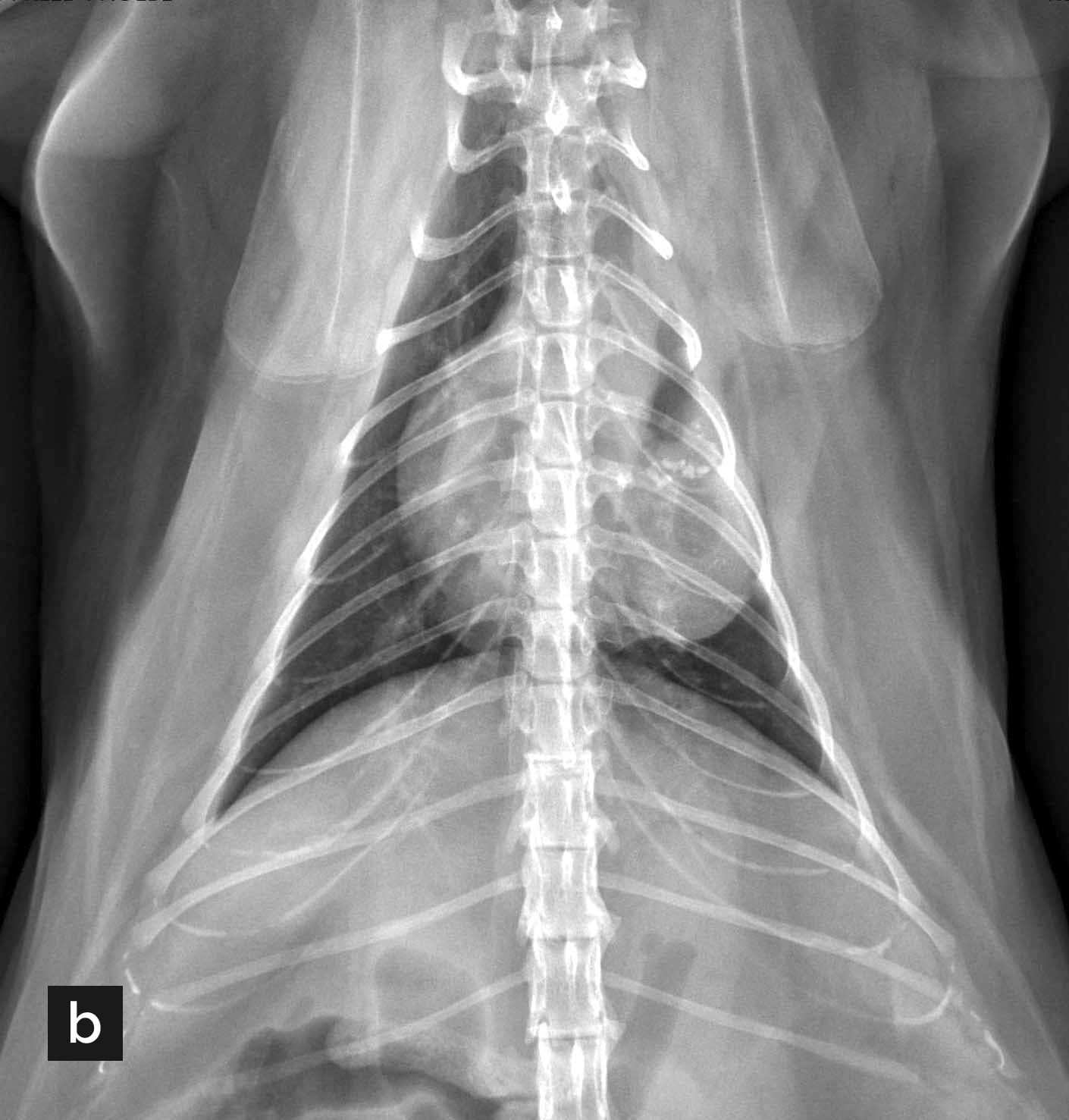 Ventrodorsal thoracic radiograph 