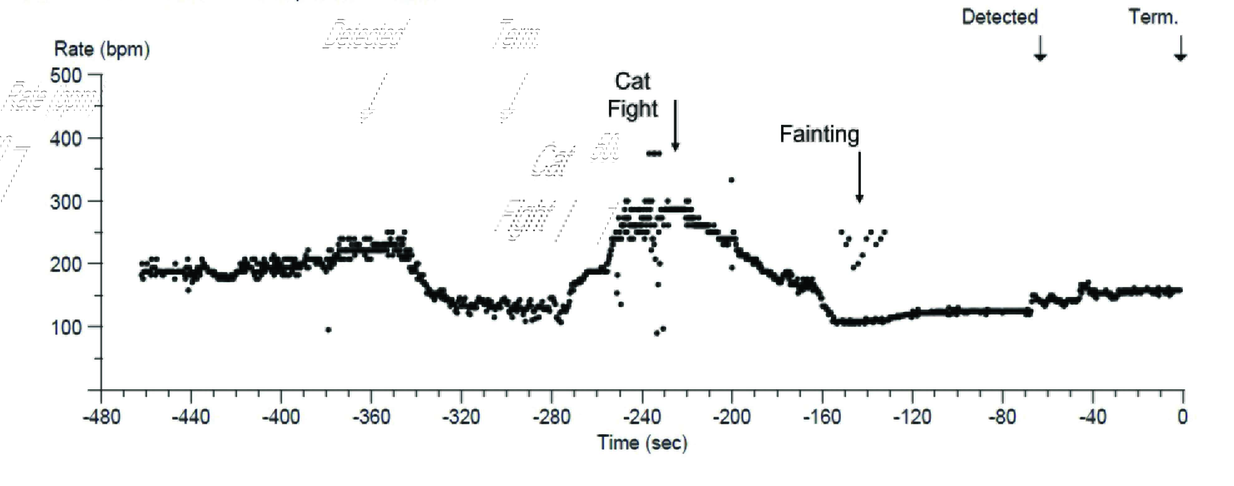ILR interrogation following another fainting episode showed a period of tachycardia during a cat fight